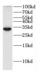 Western Blot: RBJ Antibody - BSA Free [NBP3-47984] - HeLa cells were subjected to SDS PAGE followed by western blot with ( RBJ Antibody) at dilution of 1:3000