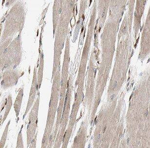 Immunohistochemistry DNAJC11 Antibody - BSA Free