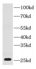 Western Blot: DNAJB8 Antibody - BSA Free [NBP3-47988] - HeLa cells were subjected to SDS PAGE followed by western blot with (DNAJB8 antibody) at dilution of 1:500