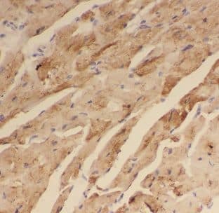 Immunohistochemistry: DNAJB5 Antibody - BSA Free [NBP3-47989] - Immunohistochemistry of paraffin-embedded human heart using (DNAJB5 antibody) at dilution of 1:50