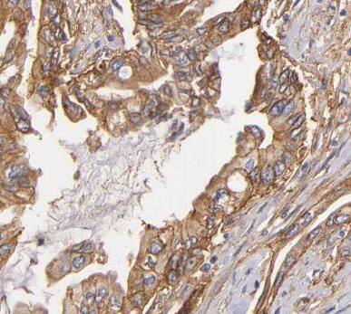 Immunohistochemistry DNAJB4 Antibody - BSA Free