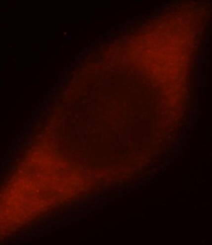 Immunocytochemistry/ Immunofluorescence: DNAJB4 Antibody - BSA Free [NBP3-47990] - Immunofluorescent analysis of MCF-7 cells, using (DNAJB4 antibody) at 1:50 dilution and Rhodamine-labeled goat anti-rabbit IgG (red)
