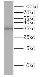 Western Blot: DNAJB13 Antibody - BSA Free [NBP3-47993] - Mouse testis tissue were subjected to SDS PAGE followed by western blot with (DNAJB13 Antibody) at dilution of 1:1000