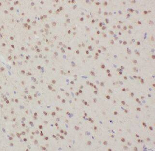 Immunohistochemistry Dynein intermediate chain 2 Antibody - BSA Free