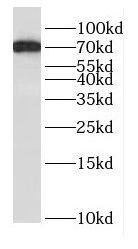 Western Blot: Dynein intermediate chain 2 Antibody - BSA Free [NBP3-47995] - Mouse lung tissue were subjected to SDS PAGE followed by western blot with (Dynein intermediate chain 2 antibody) at dilution of 1:400