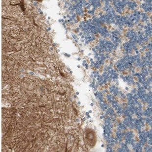 Immunohistochemistry: DMXL2 Antibody - BSA Free [NBP3-47998] - Immunohistochemistry of paraffin-embedded human cerebellum slide using (DMXL2 Antibody) at dilution of 1:50