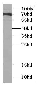 Western Blot dystrophia myotonica containing WD repeat motif Antibody - BSA Free