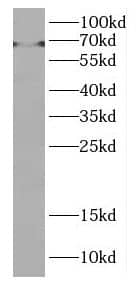 Western Blot DMRTA1 Antibody - BSA Free