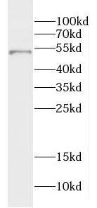 Western Blot Dermokine beta Antibody - BSA Free