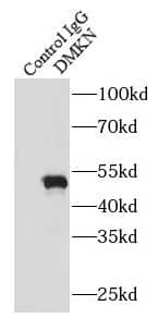 Immunoprecipitation: Dermokine beta Antibody - BSA Free [NBP3-48003] - IP Result of anti-Dermokine beta (IP:, 4ug; Detection: 1:500) with mouse lung tissue lysate 4000ug.
