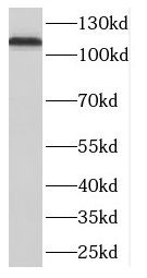 Western Blot: DLGAP3 Antibody - BSA Free [NBP3-48005] - Human brain tissue were subjected to SDS PAGE followed by western blot with (DLGAP3 antibody) at dilution of 1:500