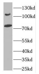 Western Blot: DLG5 Antibody - BSA Free [NBP3-48006] - PC-3 cells were subjected to SDS PAGE followed by western blot with (DLG5 antibody) at dilution of 1:500