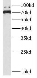 Western Blot DHX32 Antibody - BSA Free