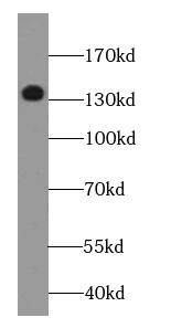 Western Blot: DGKK Antibody - BSA Free [NBP3-48018] - Human testis tissue were subjected to SDS PAGE followed by western blot with (DGKK antibody) at dilution of 1:500