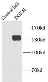 Immunoprecipitation DGKH Antibody - BSA Free