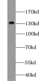 Western Blot DGKH Antibody - BSA Free