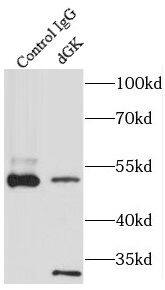 Immunoprecipitation: Deoxyguanosine kinase Antibody - BSA Free [NBP3-48020] - IP Result of anti-dGK (IP:, 3ug; Detection: 1:300) with mouse kidney tissue lysate 4000ug.