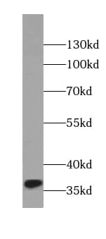 Western Blot DEPP1 Antibody - BSA Free