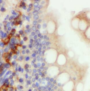 Immunohistochemistry Defensin beta 1 Antibody - BSA Free