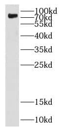 Western Blot: DEF6 Antibody - BSA Free [NBP3-48028] - Jurkat cells were subjected to SDS PAGE followed by western blot with (DEF6 Antibody) at dilution of 1:600