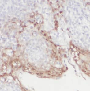 Immunohistochemistry: DEF6 Antibody - BSA Free [NBP3-48028] - Immunohistochemistry of paraffin-embedded human tonsillitis tissue slide using (DEF6 Antibody) at dilution of 1:50