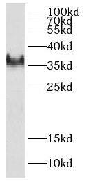 Western Blot: DEDD2 Antibody - BSA Free [NBP3-48029] - HEK-293 cells were subjected to SDS PAGE followed by western blot with (DEDD2 antibody) at dilution of 1:300