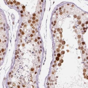 Immunohistochemistry DDX3Y Antibody - BSA Free