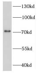Western Blot DDX3Y Antibody - BSA Free
