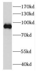 Western Blot: DDX27 Antibody - BSA Free [NBP3-48034] - HeLa cells were subjected to SDS PAGE followed by western blot with (DDX27 antibody) at dilution of 1:500