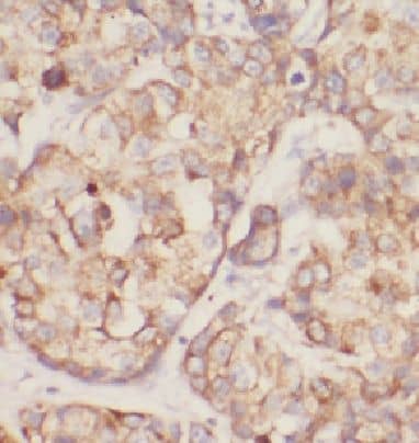 Immunohistochemistry DDRGK1 Antibody - BSA Free