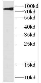 Western Blot DDHD2 Antibody - BSA Free