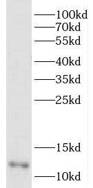 Western Blot DDA1 Antibody - BSA Free