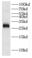 Western Blot: DCUN1D5 Antibody - BSA Free [NBP3-48041] - HeLa cells were subjected to SDS PAGE followed by western blot with (DCUN1D5 antibody) at dilution of 1:50
