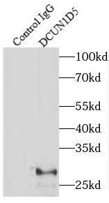 Immunoprecipitation: DCUN1D5 Antibody - BSA Free [NBP3-48041] - IP Result of anti-DCUN1D5 (IP:, 3ug; Detection: 1:800) with HeLa cells lysate 1840ug.