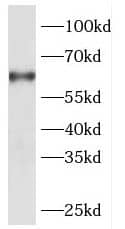 Western Blot DBR1 Antibody - BSA Free