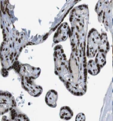 Immunohistochemistry: DBR1 Antibody - BSA Free [NBP3-48045] - Immunohistochemistry of paraffin-embedded human placenta using (DBR1 antibody) at dilution of 1:100