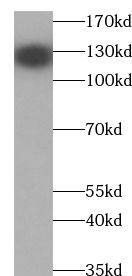 Western Blot: DAB2IP Antibody - BSA Free [NBP3-48050] - Mouse brain tissue were subjected to SDS PAGE followed by western blot with (DAB2IP Antibody) at dilution of 1:1000