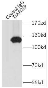 Immunoprecipitation: DAB2IP Antibody - BSA Free [NBP3-48050] - IP Result of anti-DAB2IP (IP:, 4ug; Detection: 1:1000) with mouse brain tissue lysate 4000ug.