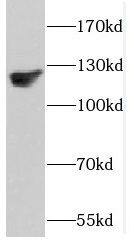 Western Blot: DAAM1 Antibody - BSA Free [NBP3-48051] - Human heart tissue were subjected to SDS PAGE followed by western blot with (DAAM1 antibody) at dilution of 1:500