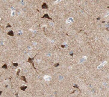 Immunohistochemistry: DAAM1 Antibody - BSA Free [NBP3-48051] - Immunohistochemistry of paraffin-embedded human brain using (DAAM1 antibody) at dilution of 1:100