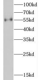 Western Blot D2HGDH Antibody - BSA Free