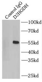 Immunoprecipitation: D2HGDH Antibody - BSA Free [NBP3-48052] - IP Result of anti-D2HGDH (IP:, 3ug; Detection: 1:500) with mouse liver tissue lysate 5000ug.