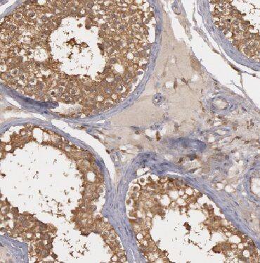 Immunohistochemistry CYTL1 Antibody - BSA Free