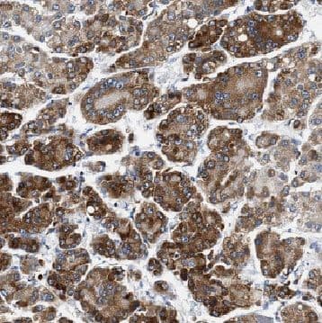 Immunohistochemistry CYP7B1 Antibody - BSA Free