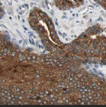 Immunohistochemistry: CYPIVF8 Antibody - BSA Free [NBP3-48058] - Immunohistochemistry of paraffin-embedded human skin tissue slide using (CYPIVF8 Antibody) at dilution of 1:50