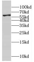 Western Blot CYP4F12 Antibody - BSA Free