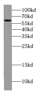 Western Blot: Cytochrome P450 4F11 Antibody - BSA Free [NBP3-48061] - Mouse skeletal muscle tissue were subjected to SDS PAGE followed by western blot with (Cytochrome P450 4F11 antibody) at dilution of 1:600