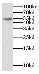 Western Blot CYP2S1 Antibody - BSA Free