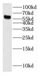 Western Blot: Cytochrome p450 2J2 Antibody - BSA Free [NBP3-48064] - Mouse skeletal muscle tissue were subjected to SDS PAGE followed by western blot with (Cytochrome p450 2J2 antibody) at dilution of 1:500