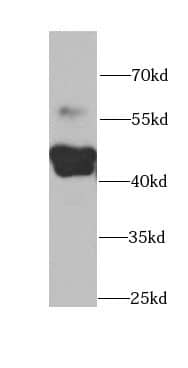 Western Blot CYP2F1 Antibody - BSA Free